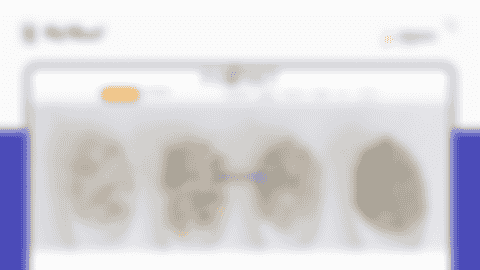 project thumbnail of ReNail